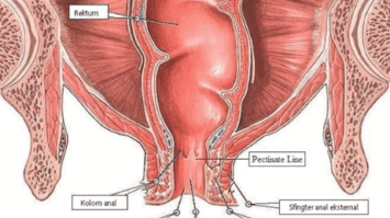 anus-8311536-2128681-png