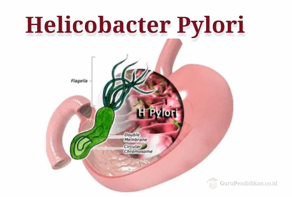 helicobacter-pylori-3977735