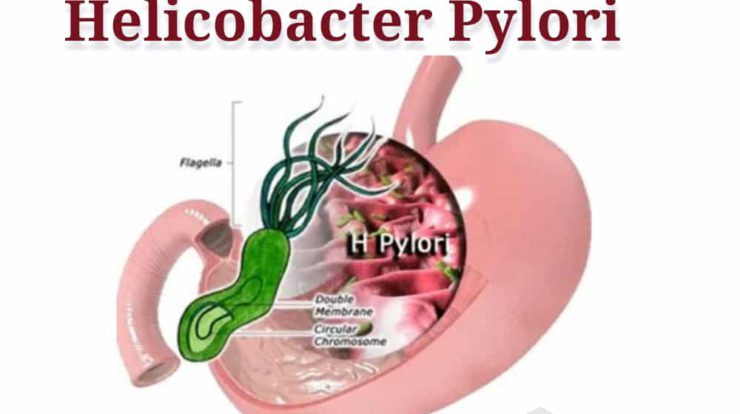 helicobacter-pylori-6347263-6608330-jpg