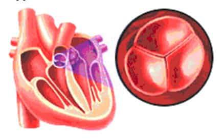 katup-pulmonal-2224125