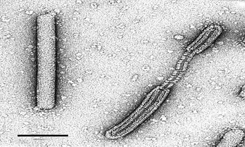 lipothrixvirus-2873566