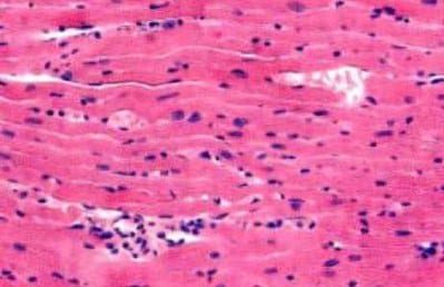 otot-jantung-2366997