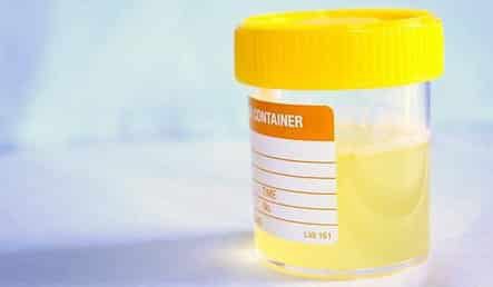 Urine urine-2765632