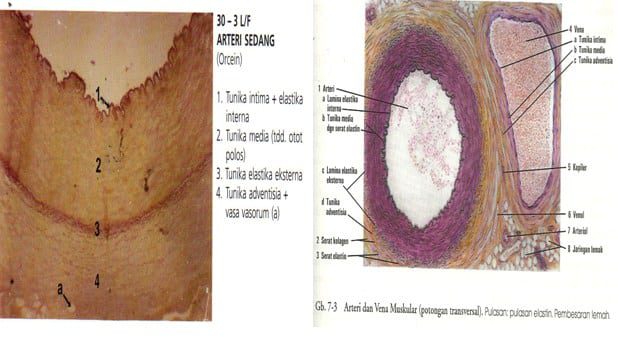arteri-2584079