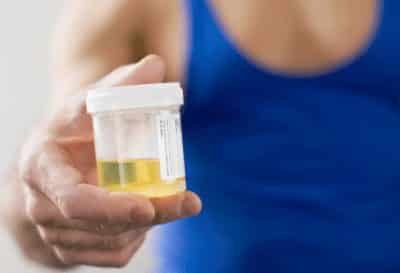 urine-2228631