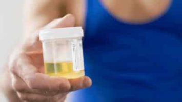 urine-2834779-1239427-jpg