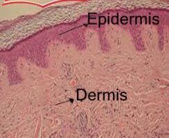epidermis-244x300-4703060-3622892-jpg