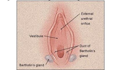 kelenjar-bartholini-dan-skene-7249057