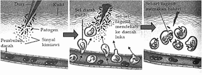 mekanisme-pertahanan-tubuh-secara-inflamasi-7072688