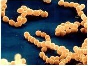 nitrosococcus-8004317