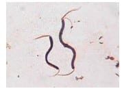 rhodospirillum-rubrum-7773512