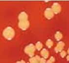 micrococcus-denitrificans-1317804