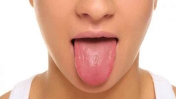 papila-2015533-8953469-jpg