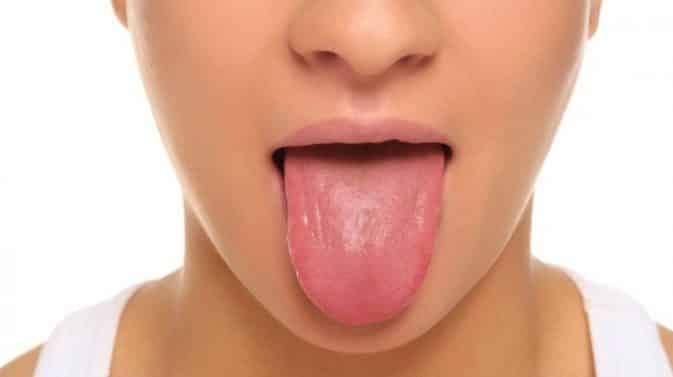 papila-2015533-8953469-jpg