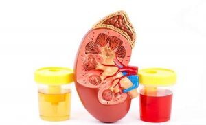 urin-300x182-9493472